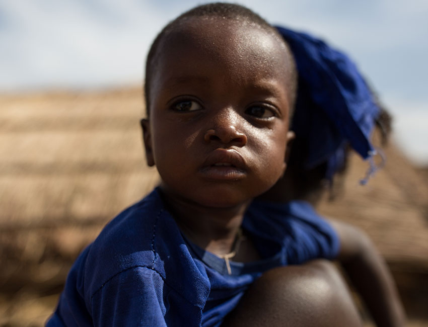 Ousmane who was treated with Pumply Nut