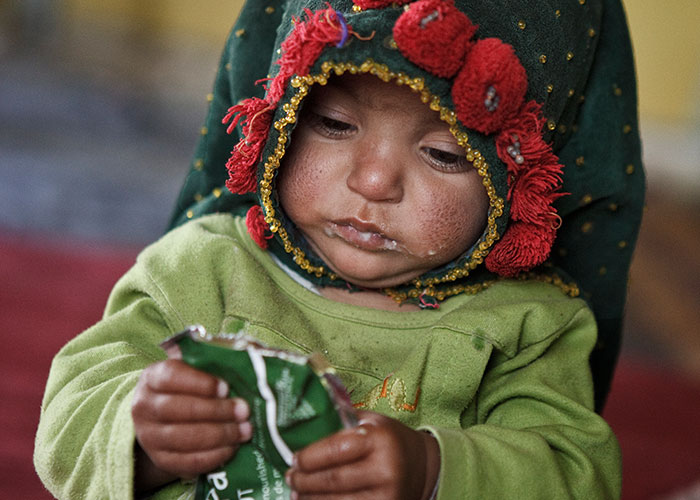 Baby in Afghanistan with Ready-to-use Therapeutic Food (RUTF)