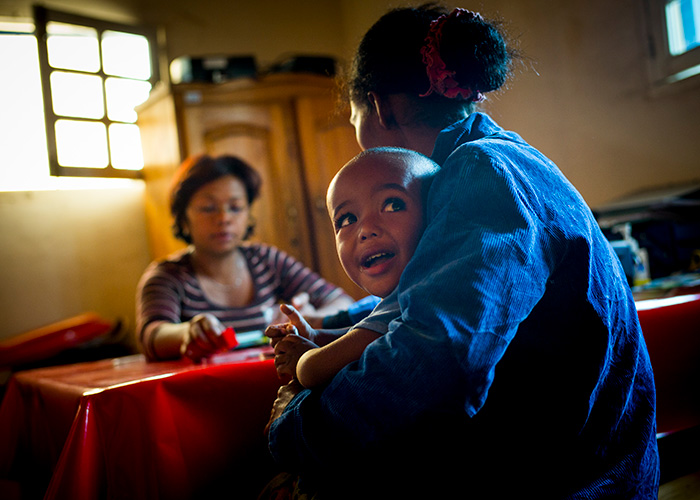 A child being treated for malnutrition in Madagascar.