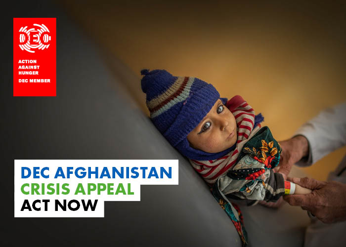A child is screened for malnutrition in Afghanistan.