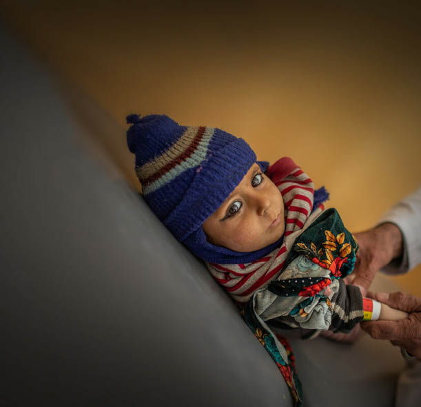 A child is screened for malnutrition in Afghanistan.