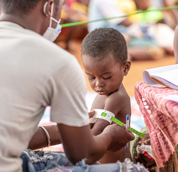 A boy in Madagascar having his arm measured by a MUAC band