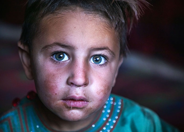 Gita, a girl supported by Action Against Hunger in Afghanistan.