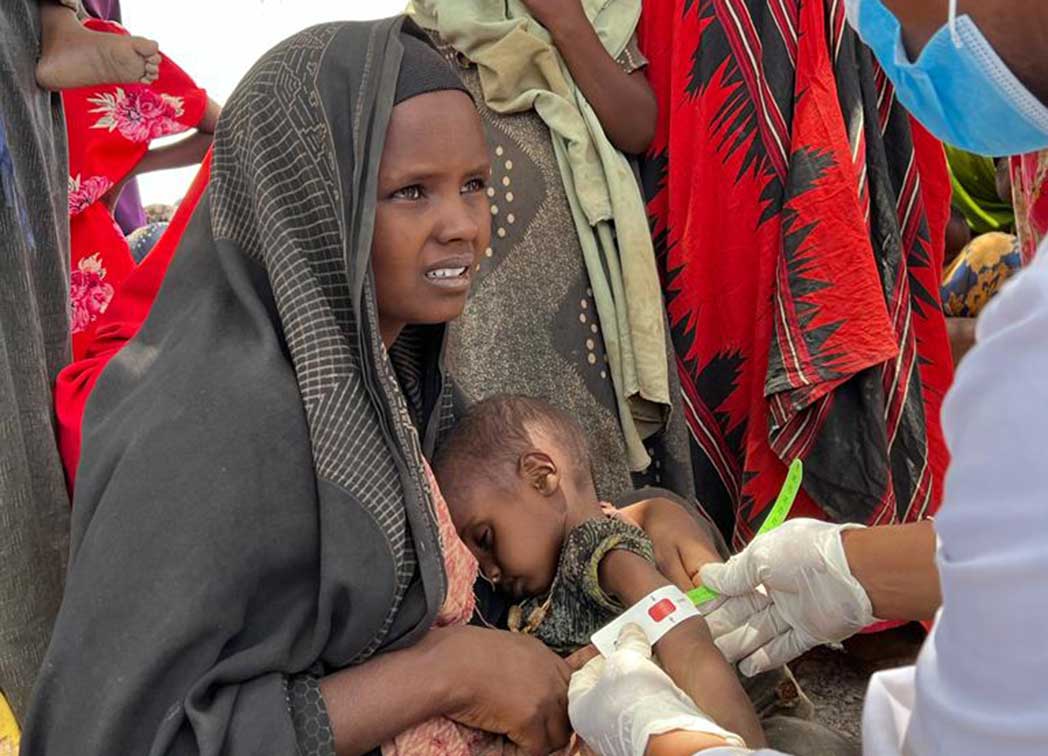 A member of Action Against Hunger’s mobile team measures Aftin’s child’s arm to check them for malnutrition. 