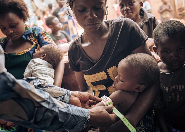 A child is screened for malnutrition at one of Action Against Hunger's health centres in the Democratic Republic of Congo.