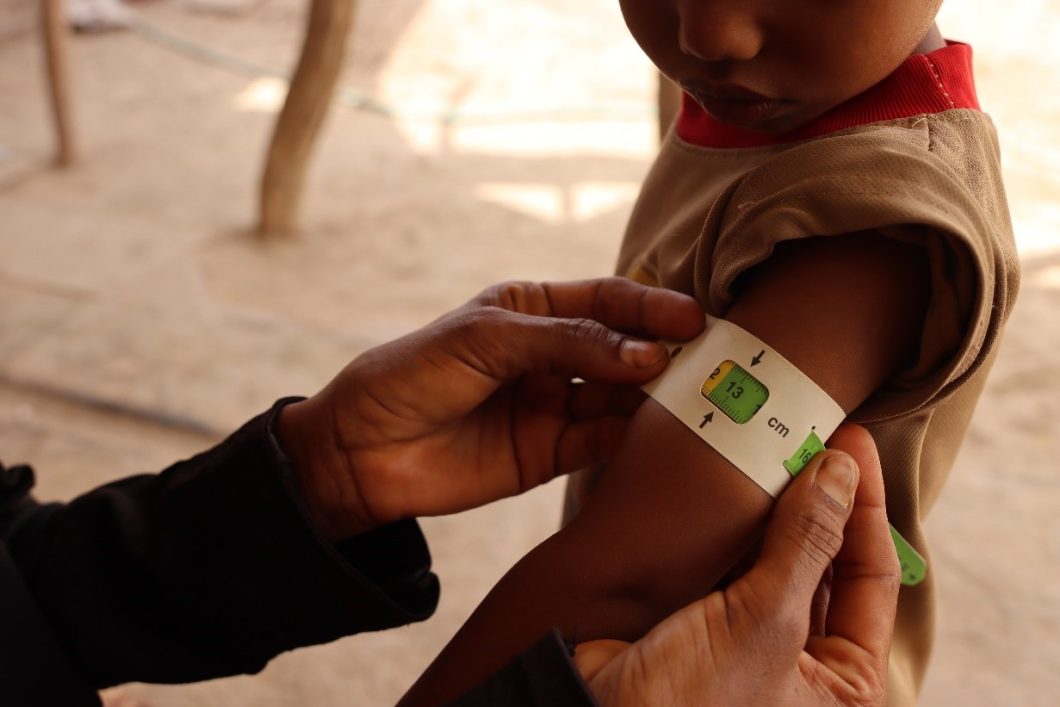 A young child in Yemen is tested for malnutrition using a MUAC band, 2021 © Action Against Hunger