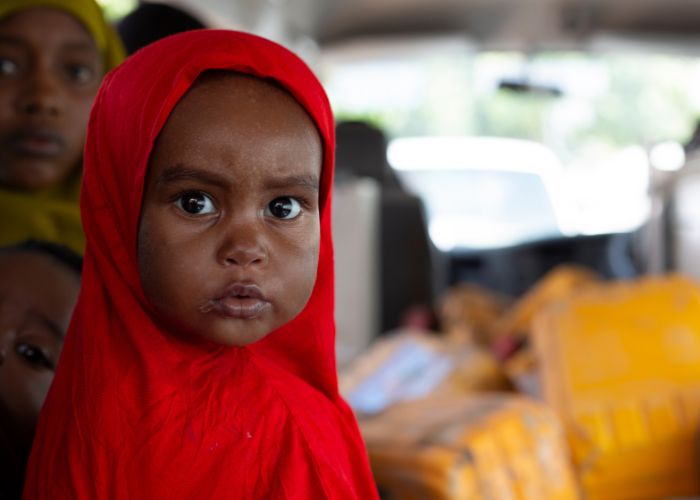 A portrait of Halima in the second week of her treatment for severe acute malnutrition.